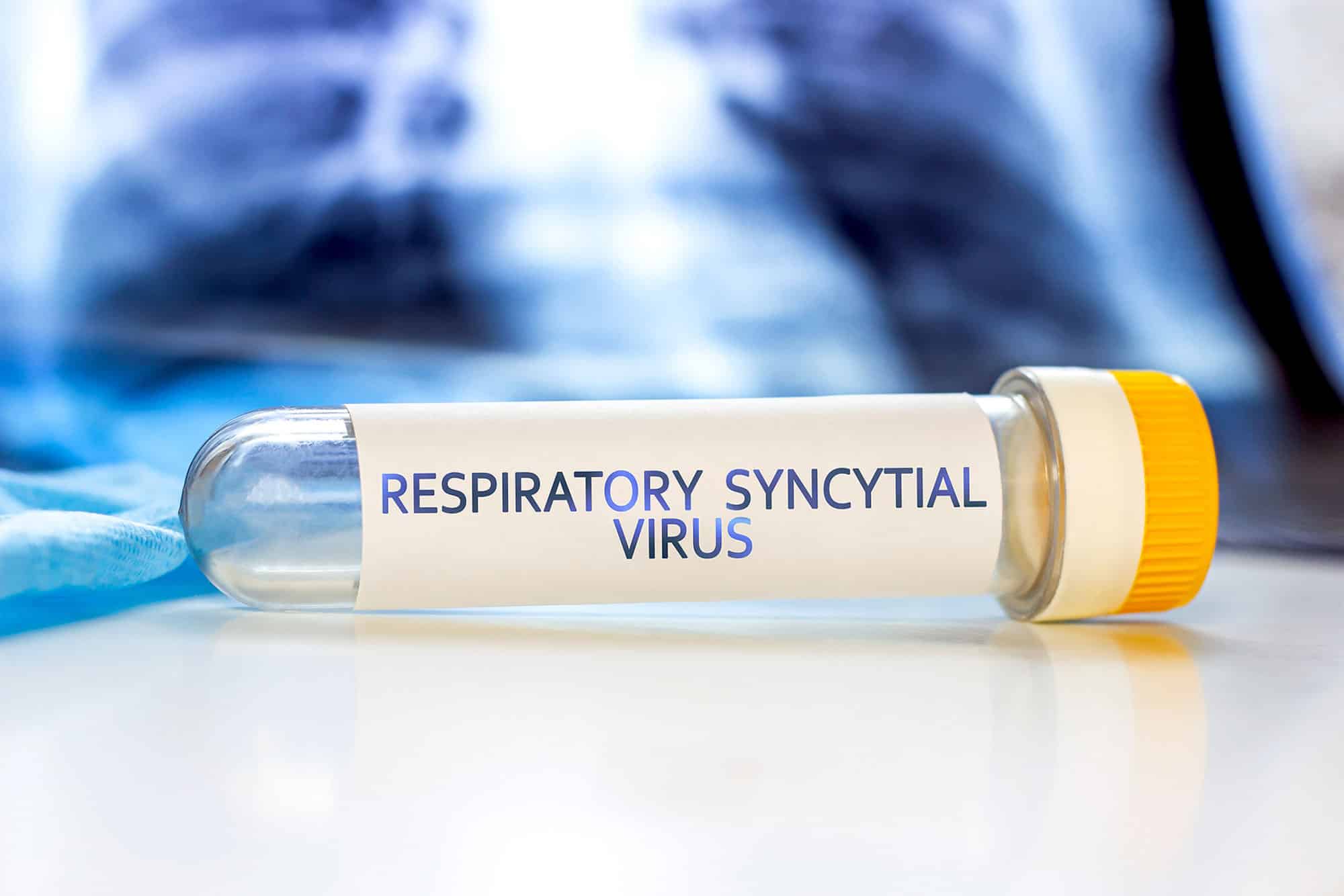 Senior home care can help minimize RSV risks in aging seniors. Senior home care can help minimize RSV risks in aging seniors.